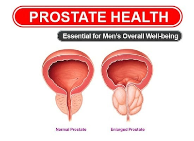 ProstaBiome / Prostate Formula.