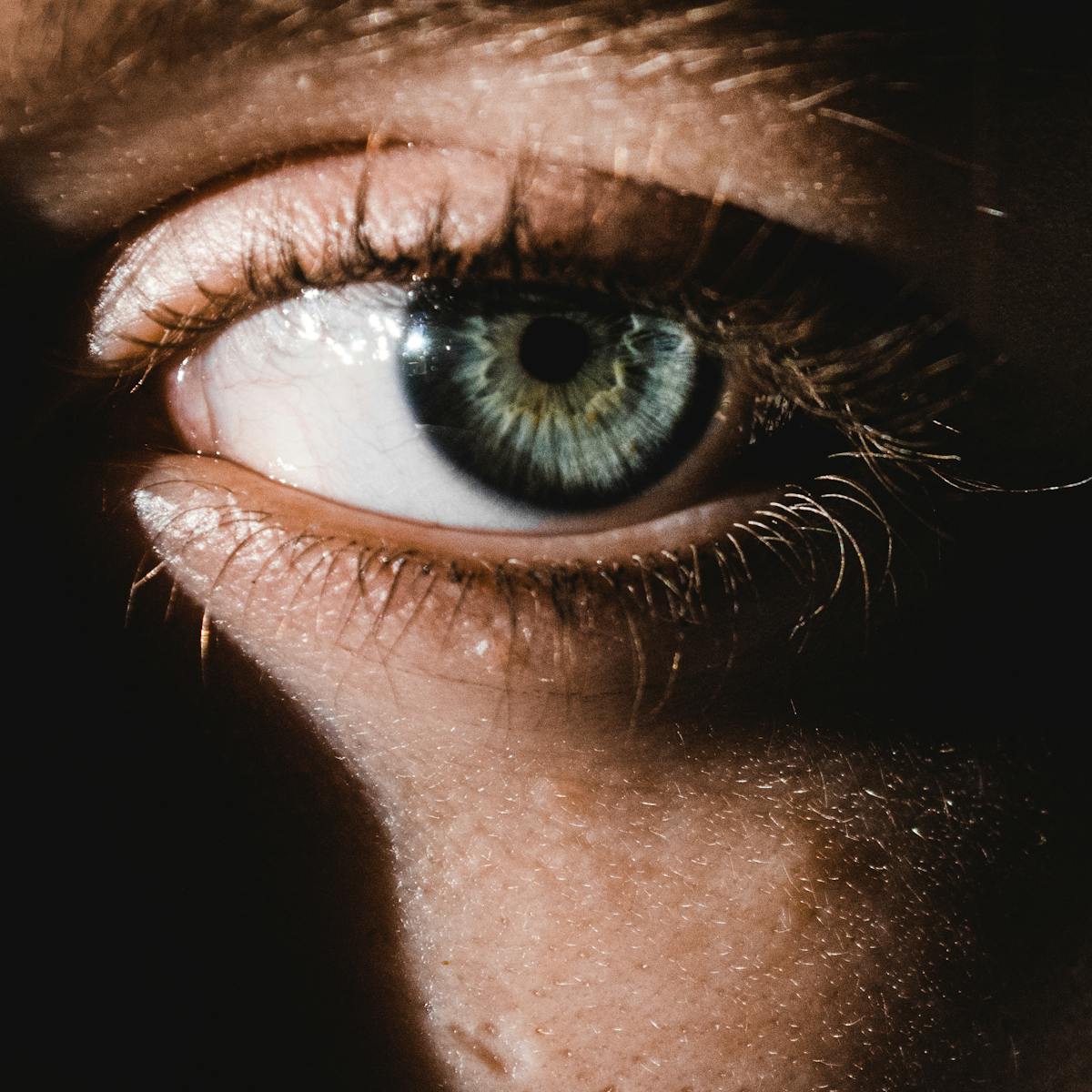 Get Rid of Those Dark Spots Around Your Eyes With Our Dark Circles Eliminator!