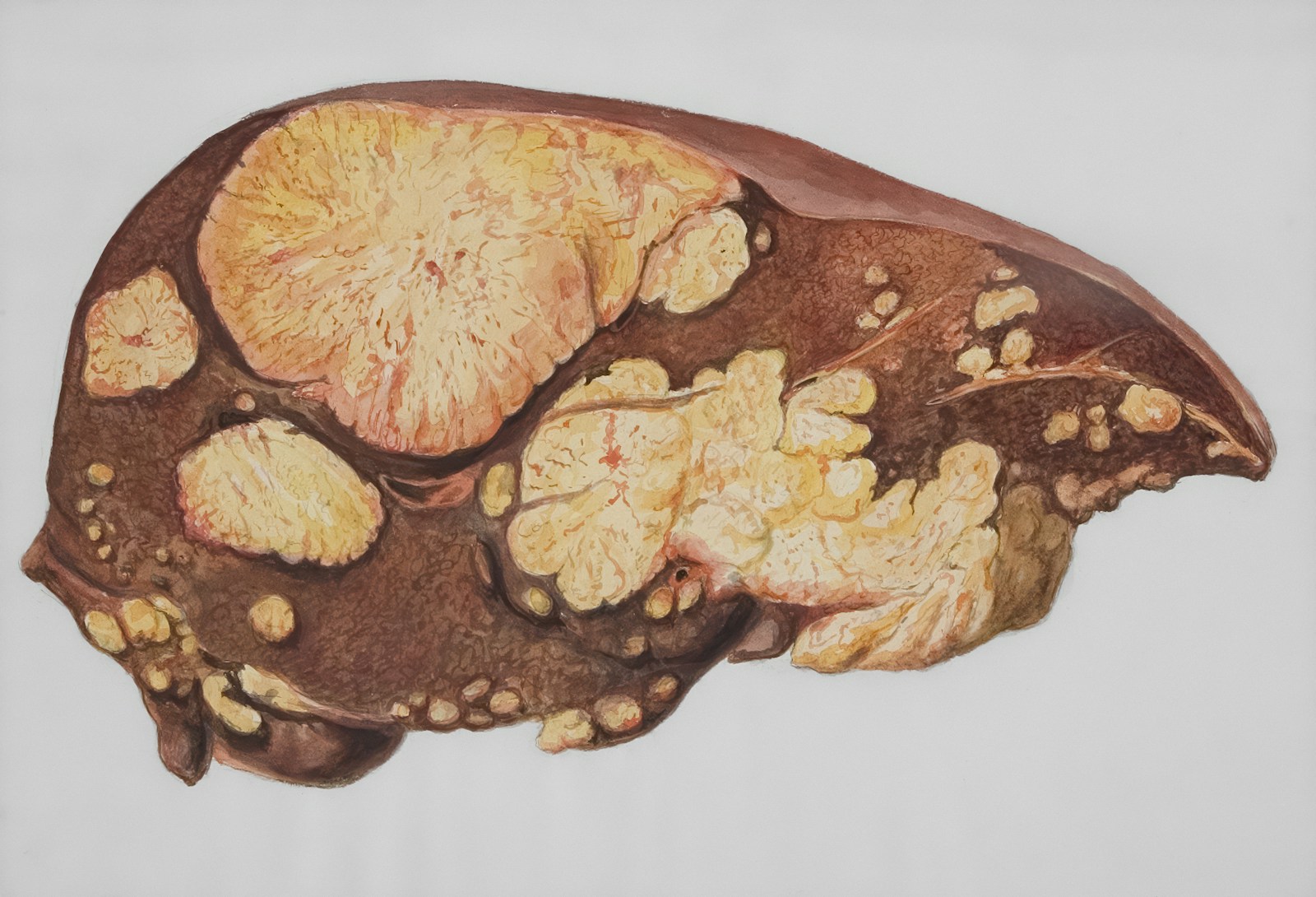 The Missing Link Between Metabolism, Fat Loss & Liver Health: What Your Body Might Be Telling You.