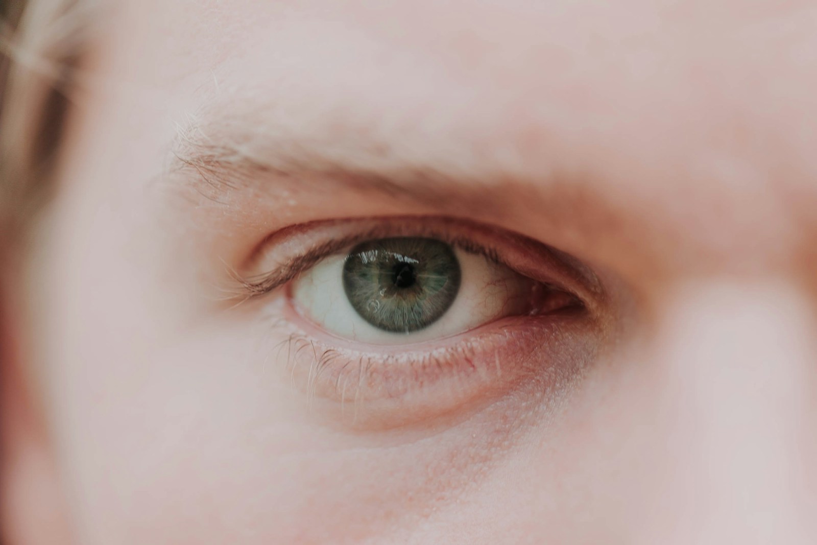Eliminate Puffy Eyes and Dark Circles with LilyAna Naturals Eye Cream.