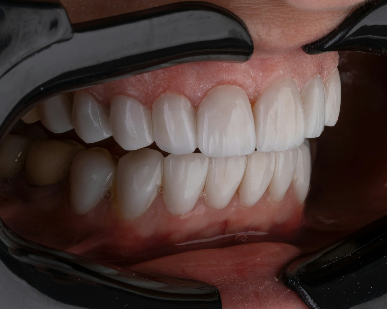DentiCore: The Hilariously Effective Oral Health Supplement Your Gums Will Thank You For!