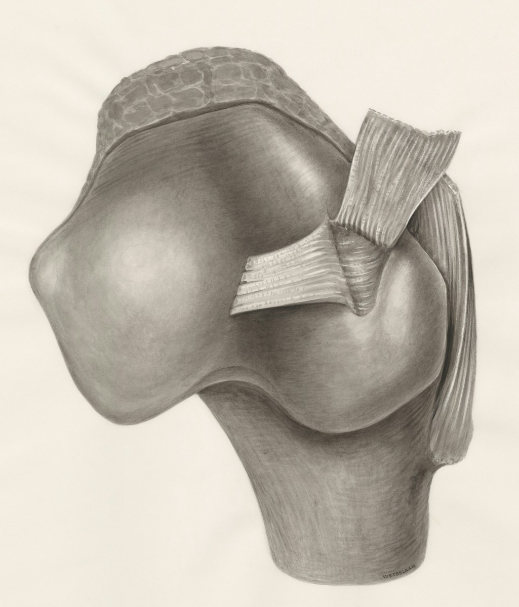 Hip Flexors / VSL with Therapy program.