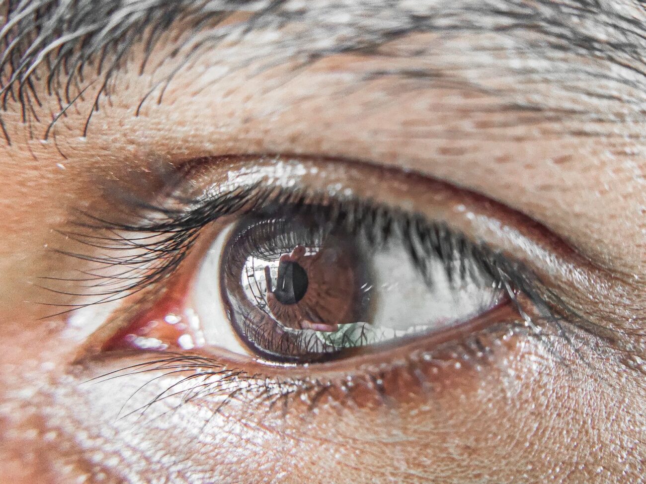 A macro close-up of a human eye and surrounding skin