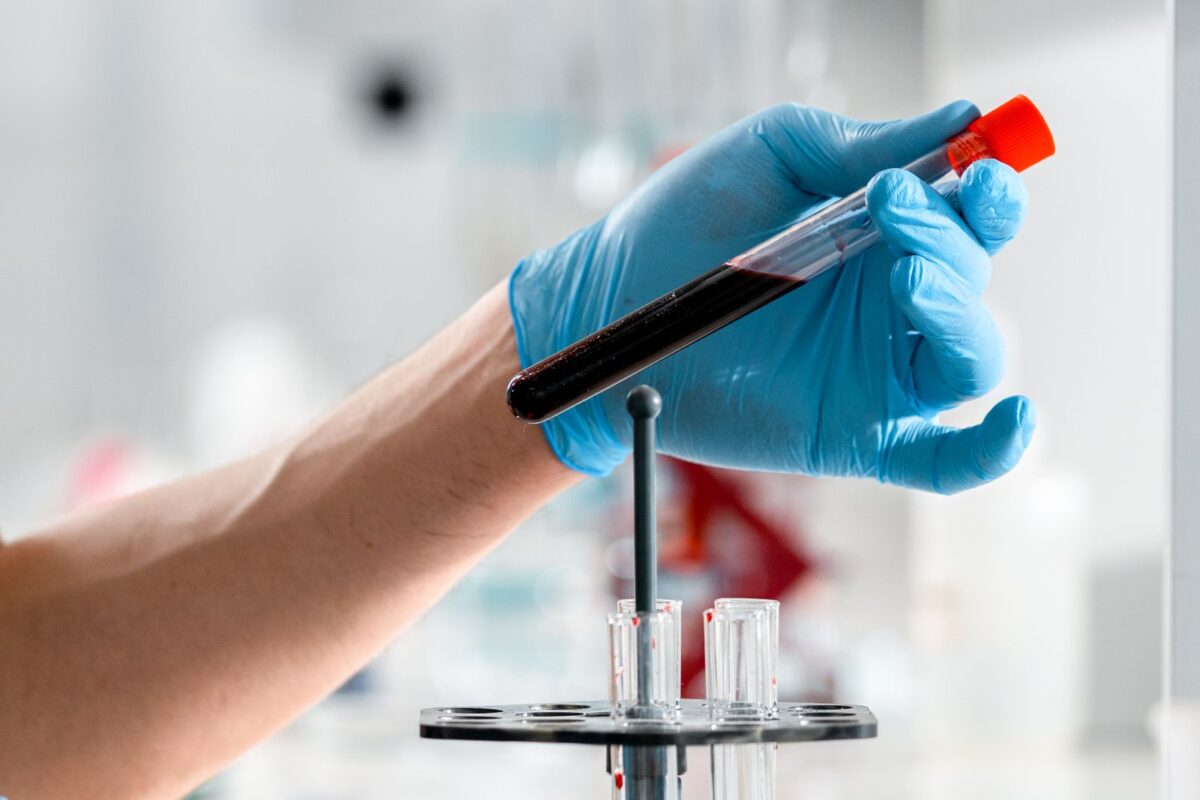 Gloved hand holding a blood sample tube in a laboratory